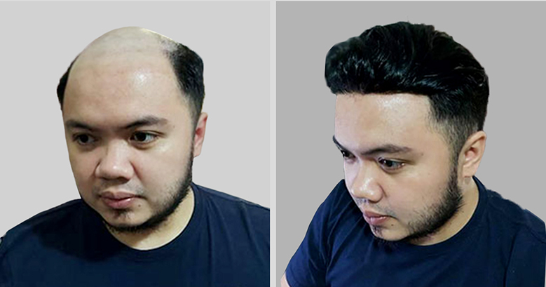 complement capillaire homme pas cher